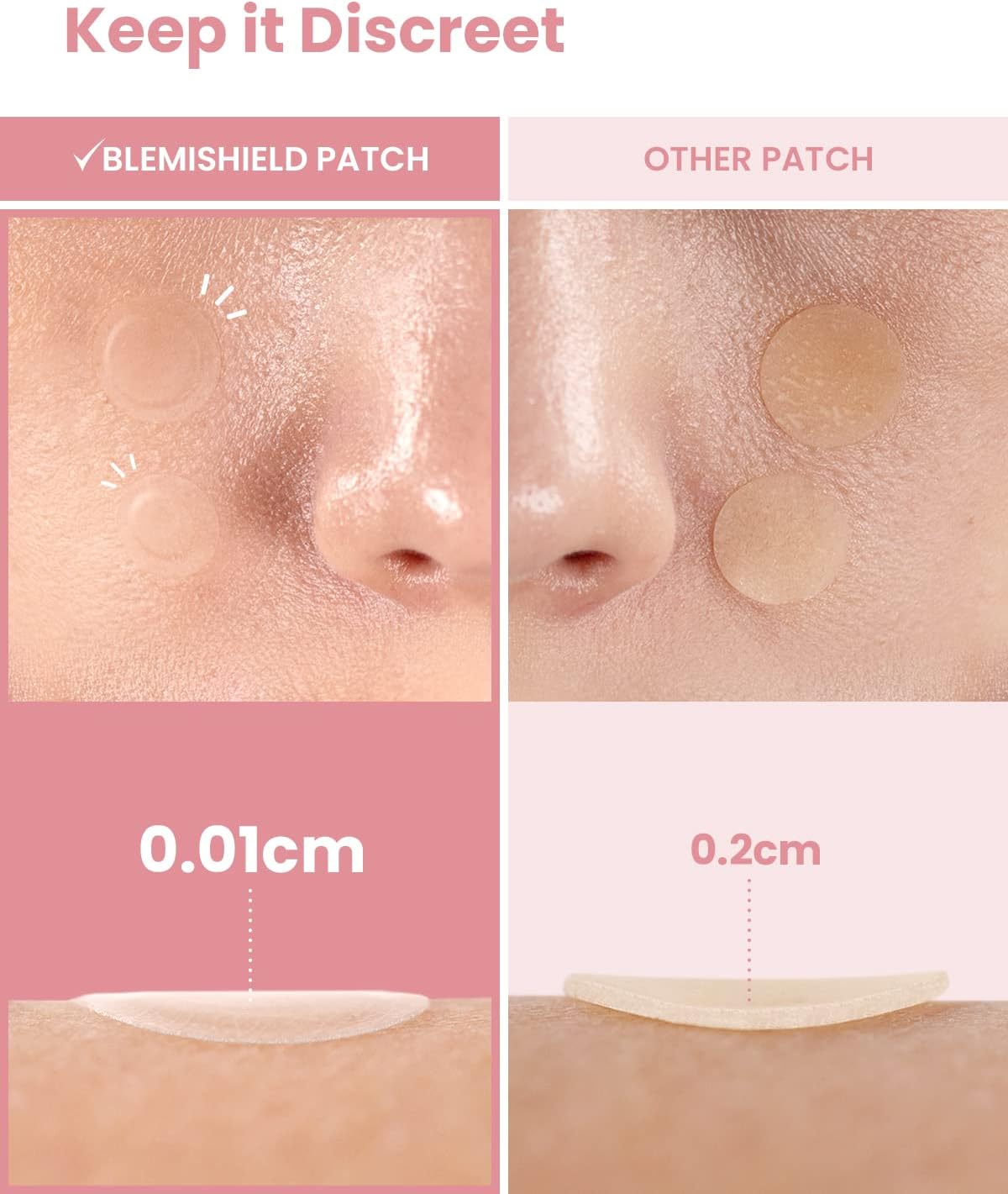 GLAM UP Hydrocolloid Blemish Pimple Zit Patches Review